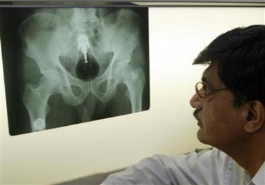 X Ray image X Ray image